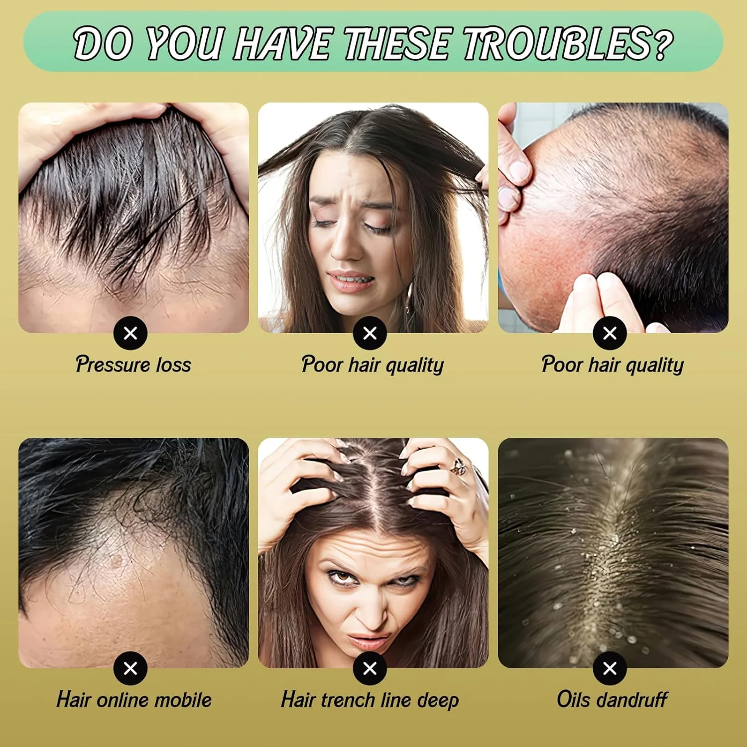 Ginger Plant Extract Anti-Hair Loss Hair Shampoo (Pack of 3) - Image 5
