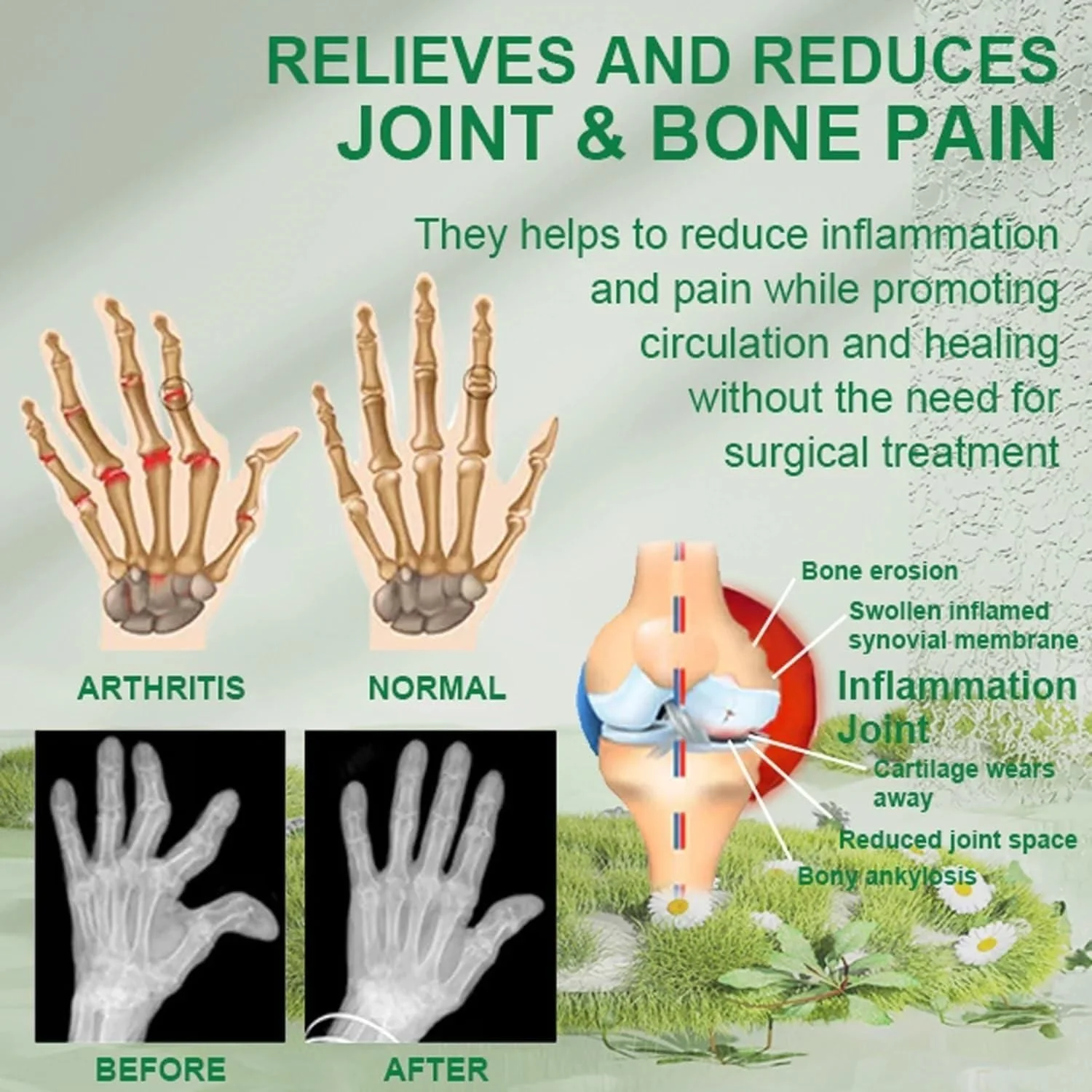 Bee Venom Joint and Bone Care Cream (Pack of 3) - Image 5