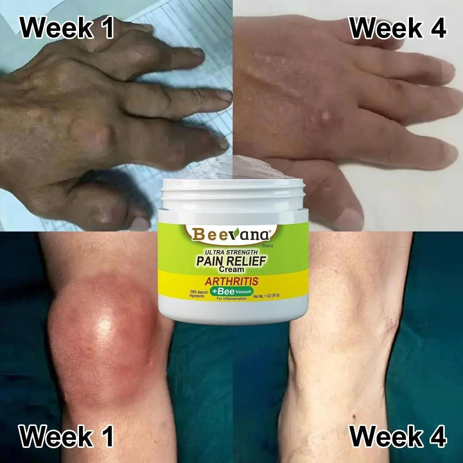 Bee Venom Joint and Bone Care Cream (Pack of 3) - Image 7