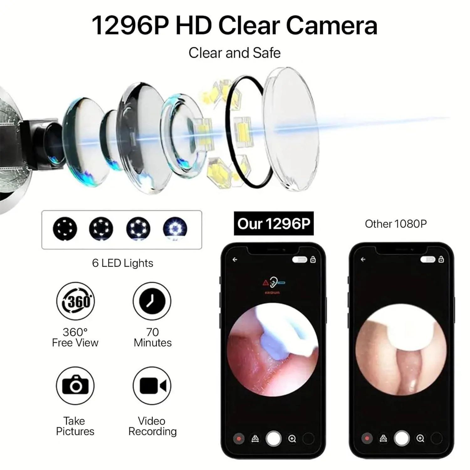 Smart Visual Ear Wax Cleaner - Image 6