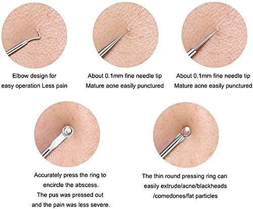 Stainless Steel Blackhead Remover Extractor Tool Set of 4 - Image 5