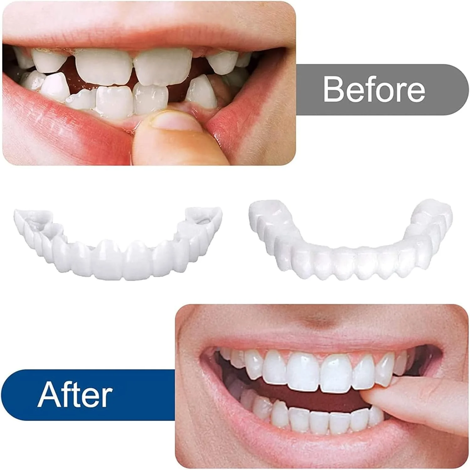 Ski&Cela SmilePro Teeth Dentures - Image 7